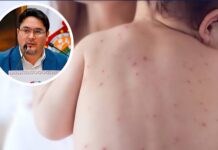 Oaxaca suma 9 casos de sarampión; uno sigue activo en San Felipe del Agua