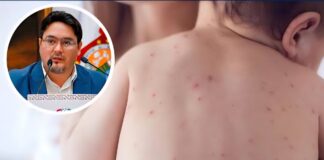 Oaxaca suma 9 casos de sarampión; uno sigue activo en San Felipe del Agua